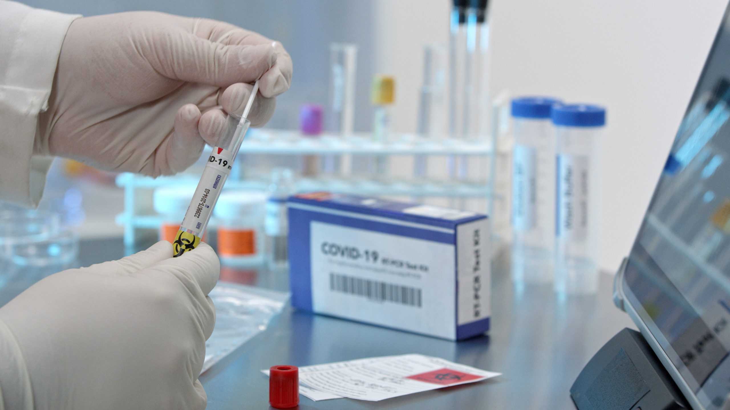 Technician,Adding,Covid-19,Swab,Into,Test,Tub,In,Medical,Lab. 千亿国际官方网站图片